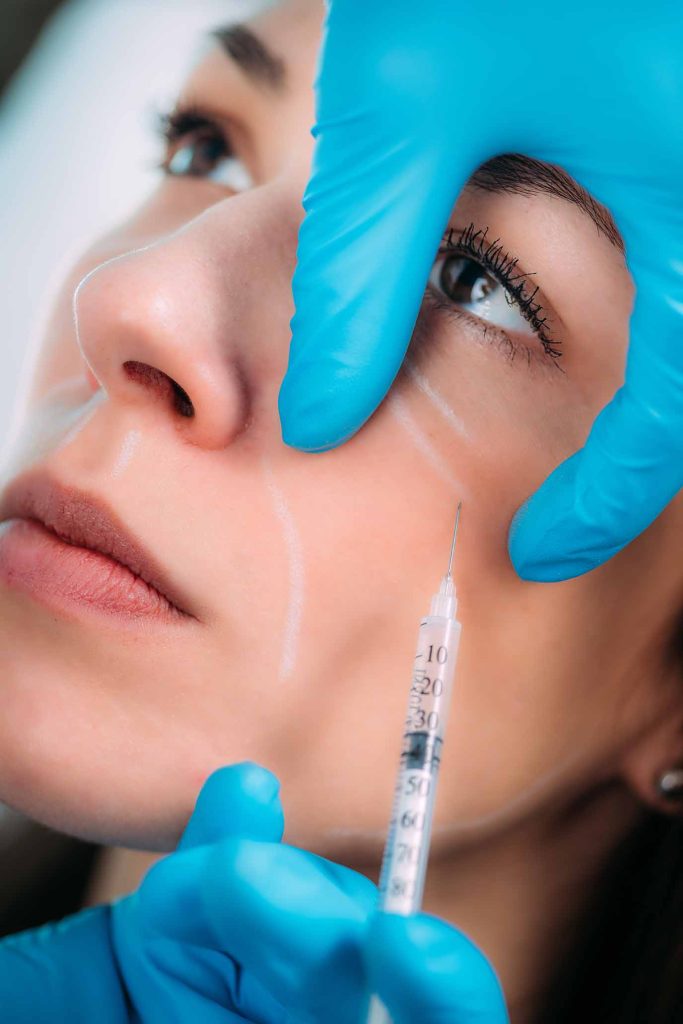 dermal fillers